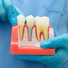 AP Super Speciality Dental