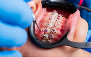 AP Super Speciality Dental