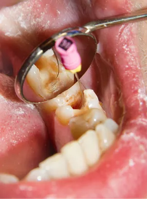 AP Super Speciality Dental